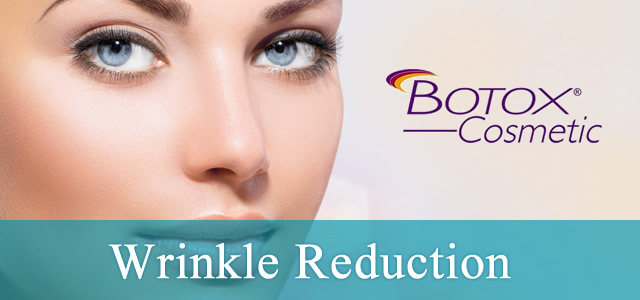 Wrinkle Reduction