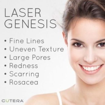 laser genesis