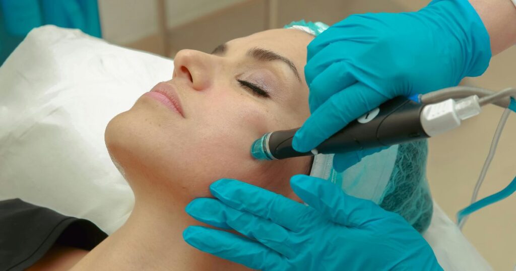 Professional HydraFacial treatment at Chic la Vie Medical Spa in Las Vegas, enhancing skin hydration, exfoliation, and rejuvenation for a radiant glow.