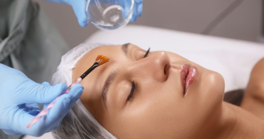Professional chemical peel treatment at Chic la Vie Medical Spa in Las Vegas, improving skin texture, reducing blemishes, and enhancing radiance for a youthful glow.