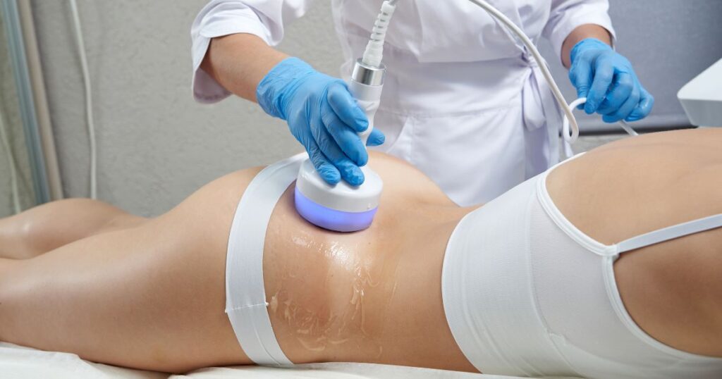 Non-invasive body contouring treatment at Chic la Vie Medical Spa in Las Vegas using advanced radiofrequency technology to reduce fat and tighten skin.