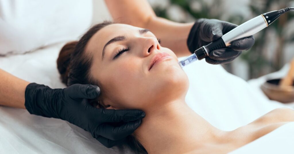 Professional microneedling treatment at Chic la Vie Medical Spa in Las Vegas, enhancing collagen production and skin rejuvenation for a youthful, radiant glow.