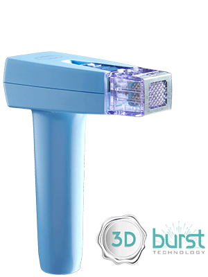 A blue handheld medical device for body contouring with a clear square tip, labeled "3D burst technology" in the lower right corner, similar to the advanced Morpheus8 Body system.