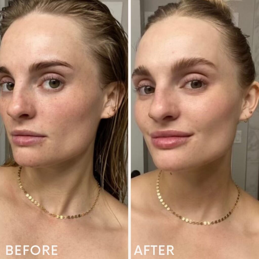 Side-by-side comparison of a woman's face before and after Morpheus8 facial treatment, revealing fuller eyebrows and smoother skin in the "after" image.