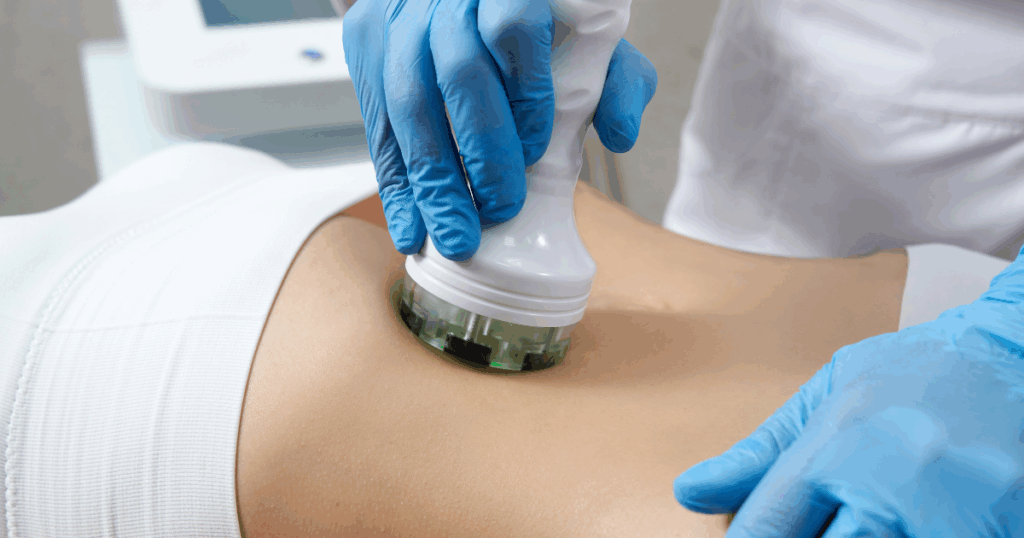 CoolSculpting applicator treating the abdomen for non-surgical fat reduction and body contouring in Las Vegas