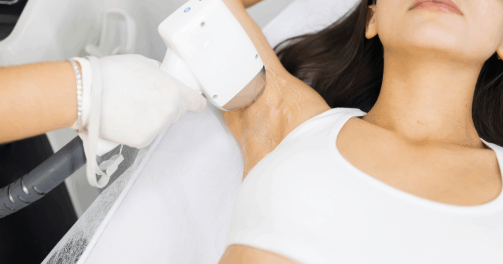 Laser hair removal treatment on underarm using advanced laser technology for long-term hair reduction in Las Vegas